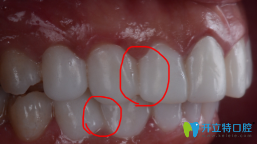 瓷貼面沒(méi)有縫隙