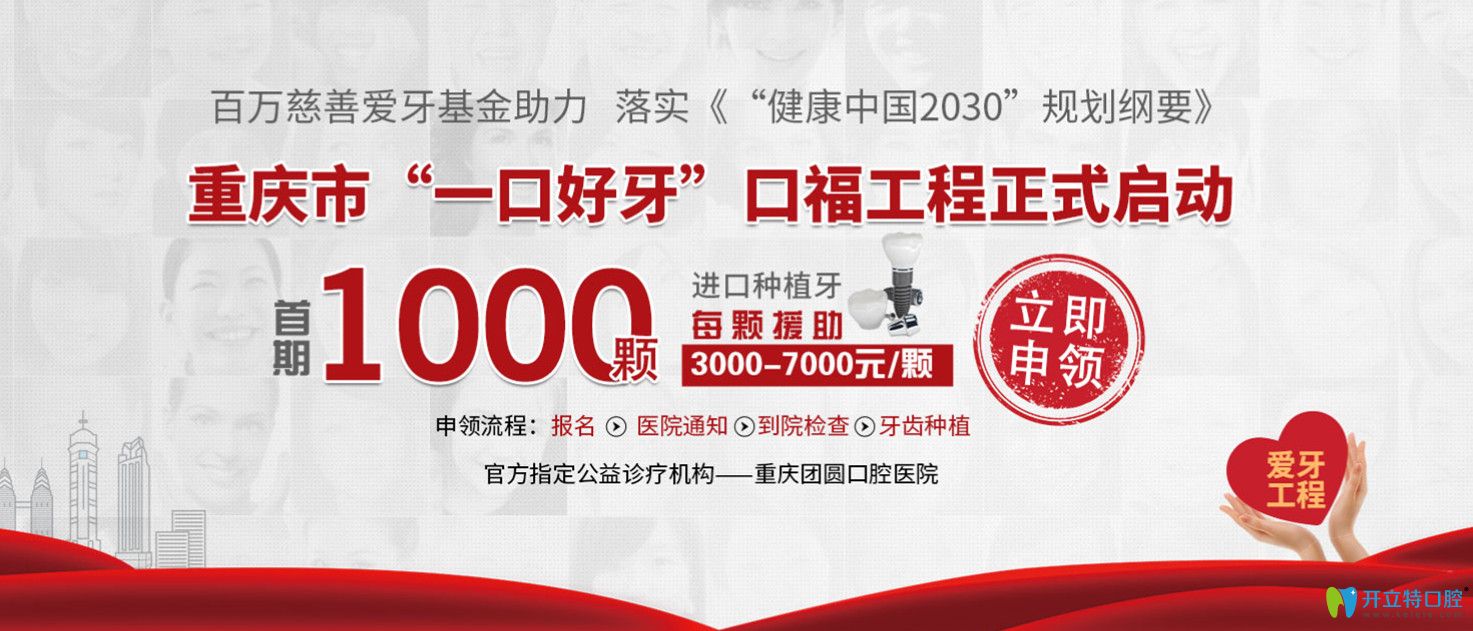 進(jìn)口種植牙貴嗎?來(lái)重慶團(tuán)圓口腔做韓國(guó)種植牙可援助3-7千元