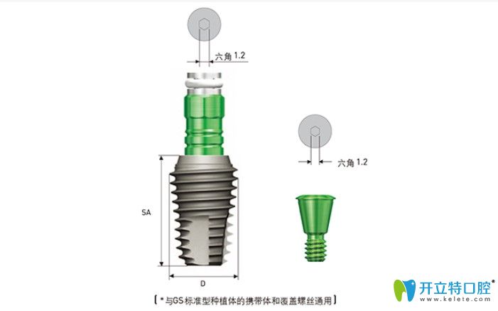 韓國奧齒泰超寬種植體