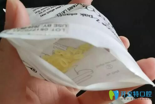 我在靖江艾齒嘉口腔做矯正期間戴的皮筋 我在靖江艾齒嘉口腔做矯正期間戴的皮筋