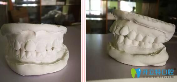 我在靖江艾齒嘉口腔的牙膜 我在靖江艾齒嘉口腔的牙膜