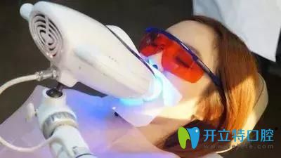 冷光美白牙齒
