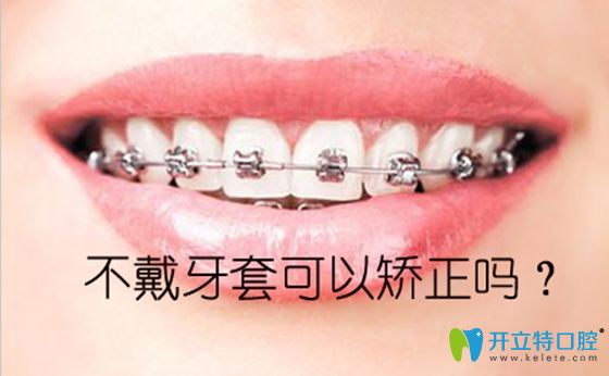 想整牙但不想帶牙套,請看不戴牙套矯正牙齒的方法