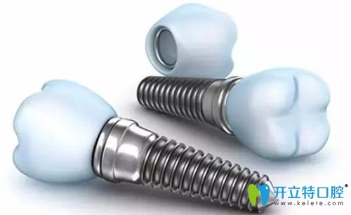 濟(jì)南韓氏口腔韓國進(jìn)口種植體+仿生冠僅需4999元