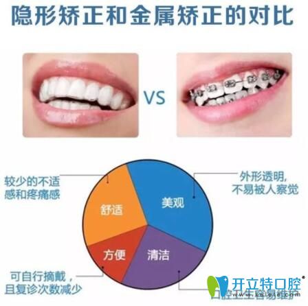 金屬矯正和隱形矯正區(qū)別