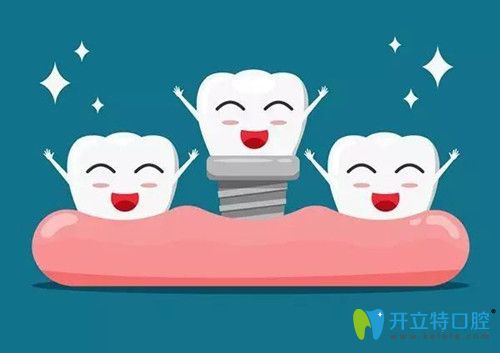 種植牙怎么樣