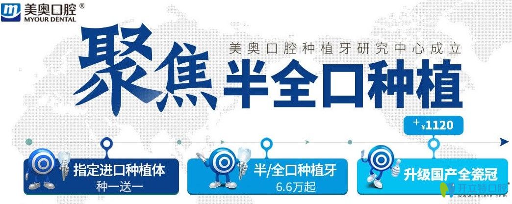 超劃算！杭州美奧口腔美國皓圣和法國安卓健都是種1送1吶