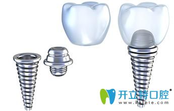 雅定和奧齒泰哪個(gè)好