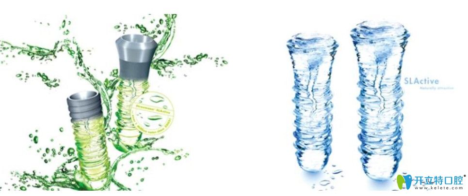 在鵬程口腔選擇瑞士iti親水種植牙