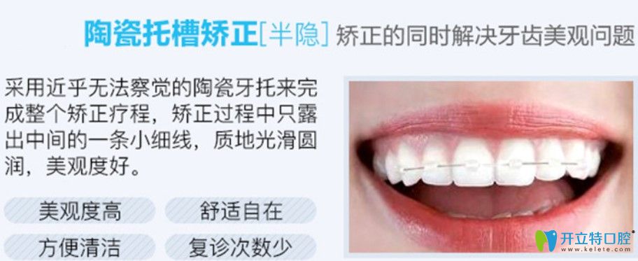 半隱形陶瓷托槽矯正價(jià)格