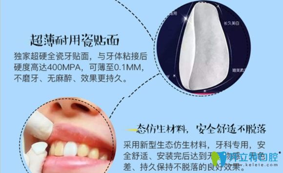 韋博口腔的E-max瓷貼面美白優(yōu)勢(shì)介紹圖