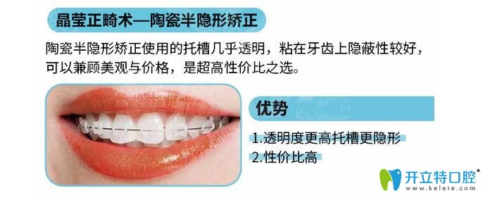 陶瓷托槽半隱形矯正優(yōu)勢(shì) 陶瓷托槽半隱形矯正優(yōu)勢(shì)