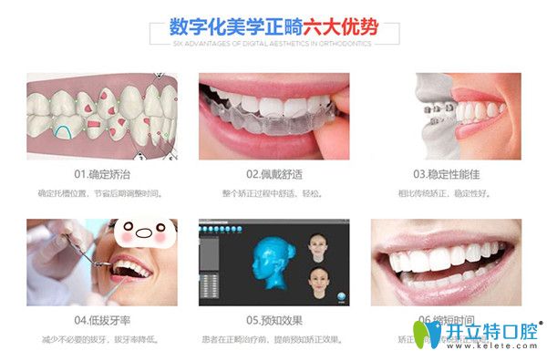 數(shù)字化美學正畸六大優(yōu)勢