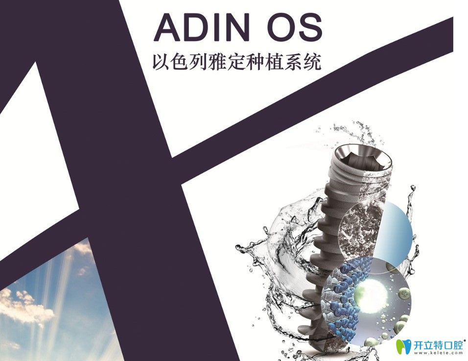 以色列adin種植體好嗎