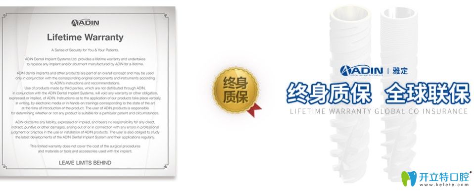 以色列雅定種植體是終身質(zhì)保