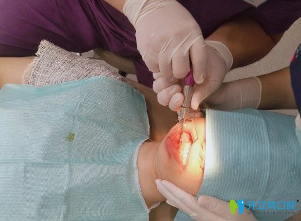 在長沙中諾口腔做適美隱形矯正打支抗釘?shù)恼掌? border=