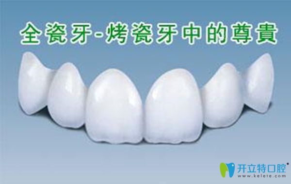 全瓷牙冠圖片展示