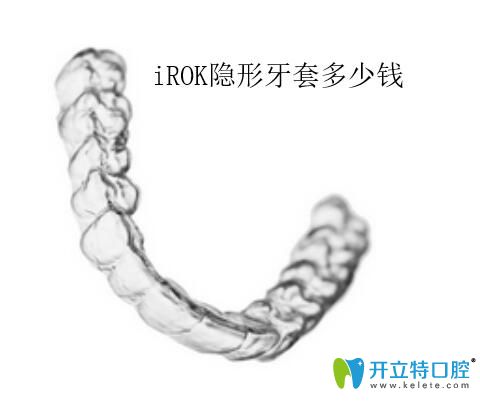 irok隱形牙套費用