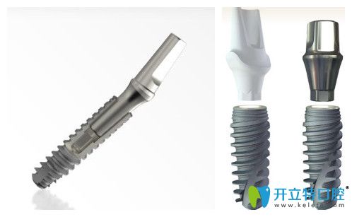 法國安卓健與諾貝爾種植體價(jià)格