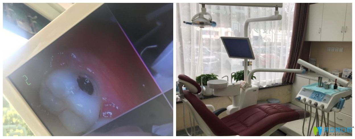 網(wǎng)友點(diǎn)評(píng)<!--<i data=20240703-sp></i>-->補(bǔ)牙好嗎