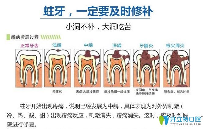 雙11圣貝牙科補牙也有優(yōu)惠