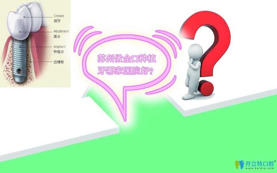 求問(wèn):蘇州做全口種植牙口碑好價(jià)格又適中的口腔醫(yī)院有哪些?