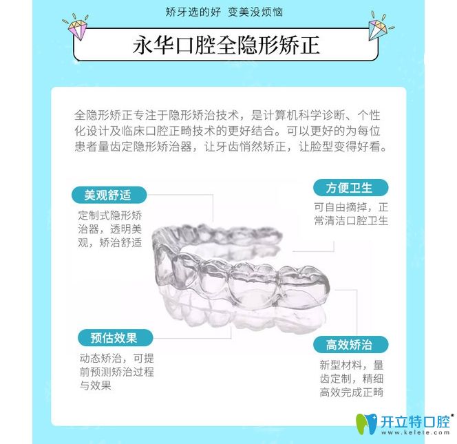 全隱形矯正優(yōu)點(diǎn)介紹