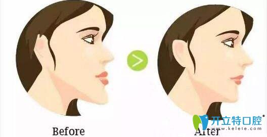 正畸難度不同費用有差異