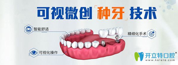 微創(chuàng)即刻種植牙