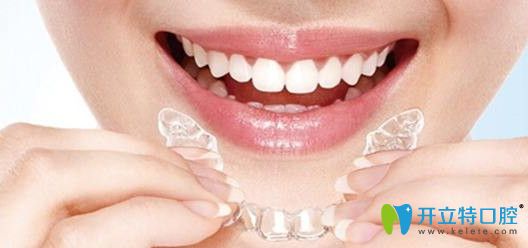 正畸時(shí)需遵循醫(yī)囑定期復(fù)診