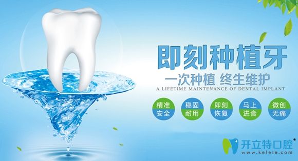 即刻種植牙技術(shù)優(yōu)勢(shì)宣傳圖