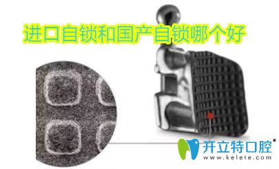 金屬自鎖托槽是國(guó)產(chǎn)還是進(jìn)口的好