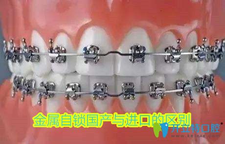 金屬自鎖是國(guó)產(chǎn)和進(jìn)口的區(qū)別