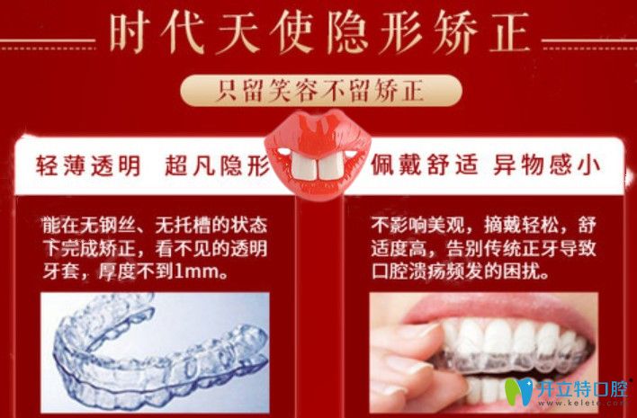 寧波藝星口腔時(shí)代天使牙套價(jià)格