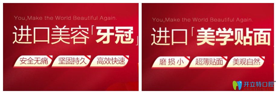 寧波藝星口腔進(jìn)口牙齒貼面價(jià)格