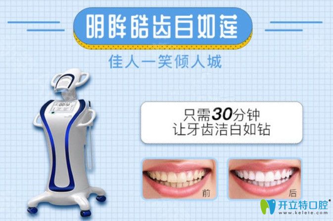 寧波藝星皓齒美白價(jià)格