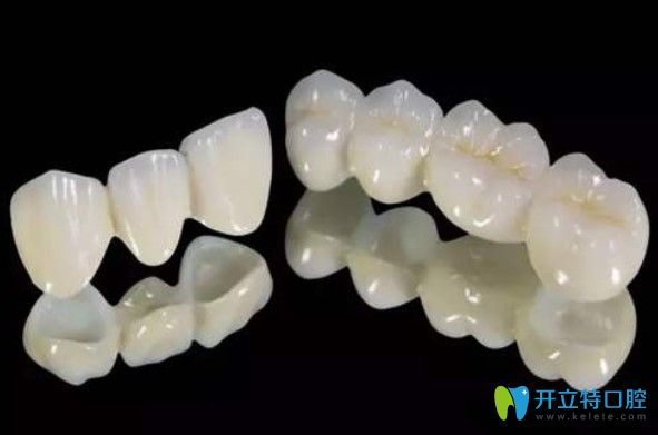 陳醫(yī)生對于牙齒修復(fù)的幾個(gè)問題的解答