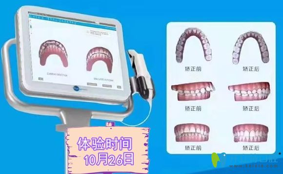3shape口腔掃描儀效果展示