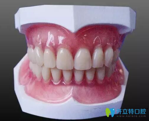 一顆牙沒(méi)有怎么鑲牙?看鑲?cè)谘纼r(jià)格含滿(mǎn)口義齒和種牙價(jià)格