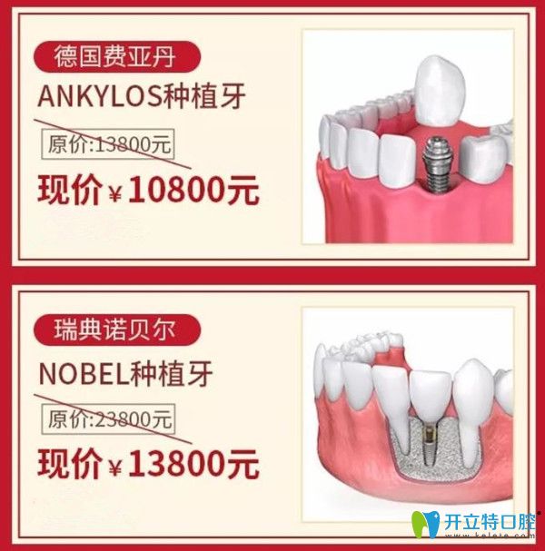 東莞好佰年口腔德國種植牙價(jià)格