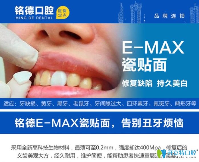 深圳銘德口腔瓷貼面修復(fù)優(yōu)勢(shì)