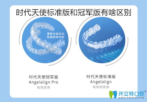 時代天使加強版比標準版貴嗎？看標準版和加強版價格區(qū)別