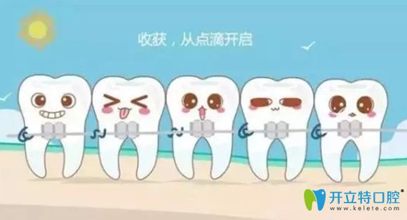 根管治療后還能箍牙嗎，醫(yī)生說可以的