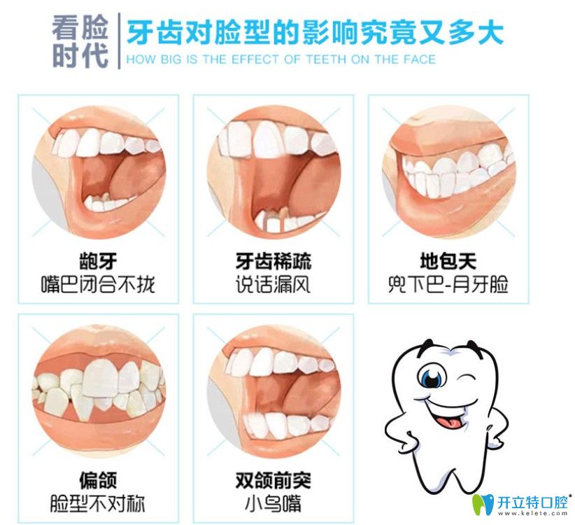 畸形的牙齒對臉型的影響