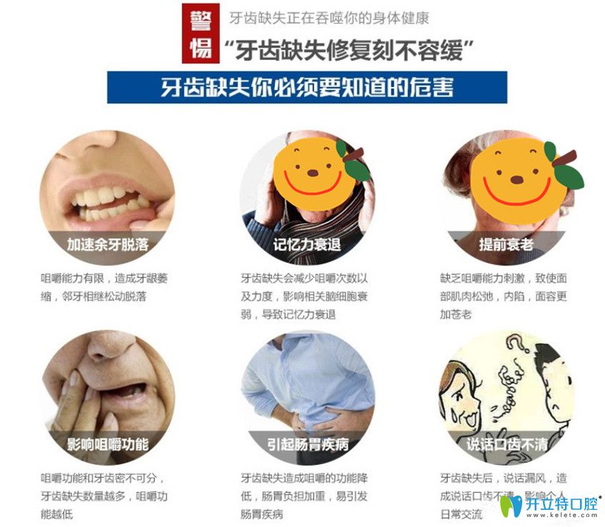 佳美口腔為缺牙父母獻(xiàn)禮種牙價格鉅惠來襲