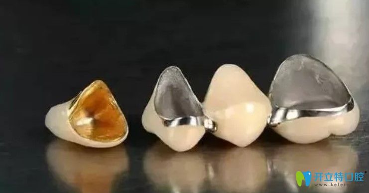全瓷牙和烤瓷牙比較