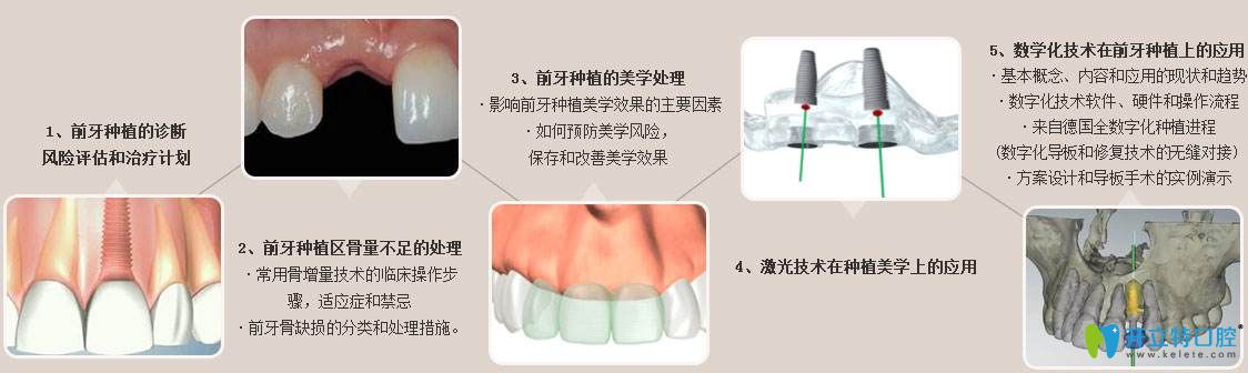 美學(xué)種植技術(shù)