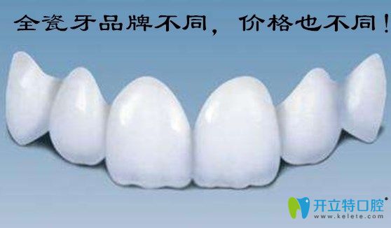 武漢做全瓷牙多少錢一顆