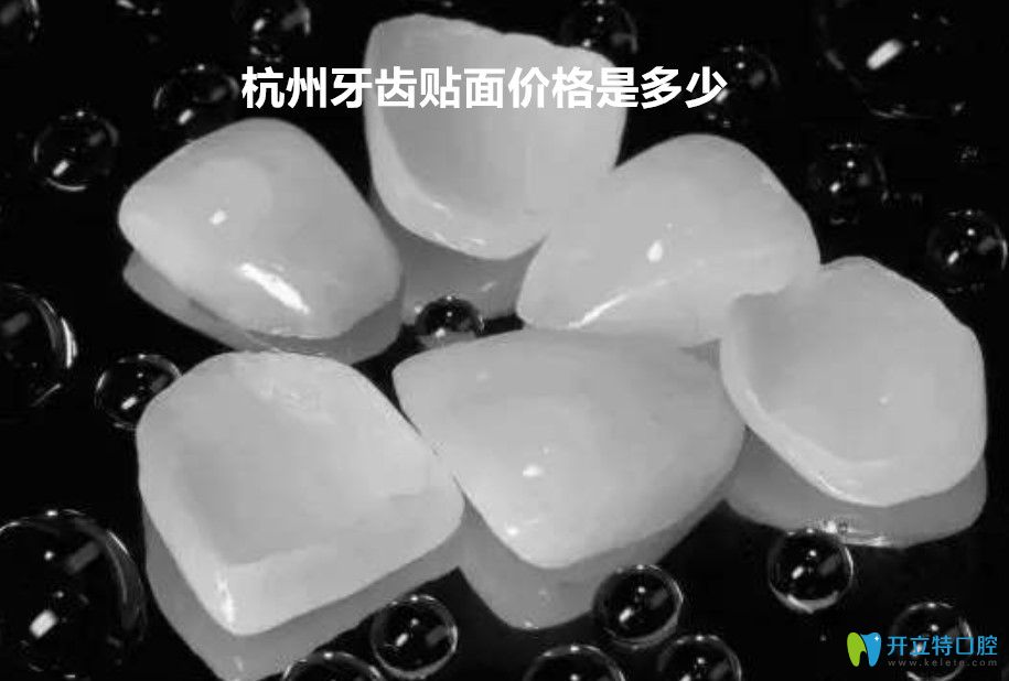 戳這里了解杭州瓷貼面價格表和杭州超薄牙貼面哪里做的好