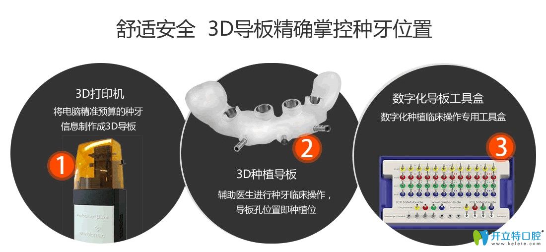 3D導板種植牙技術